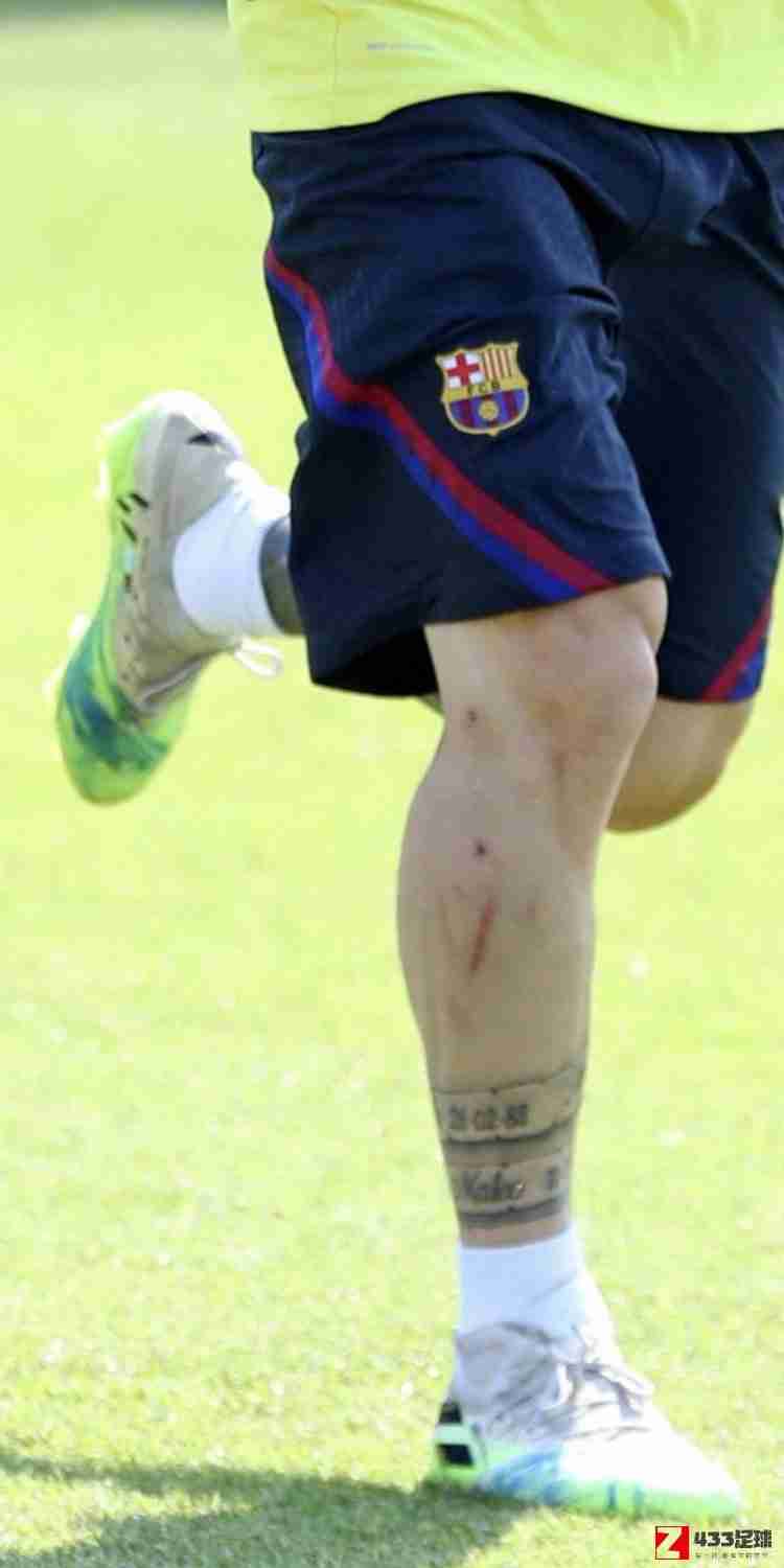 梅西,跟队记者晒梅西今日训练照：右腿血痕明显